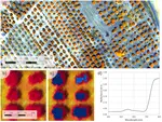 Detection of Xylella Fastidiosa Infection Symptoms with Airborne Multispectral and Thermal Imagery: Assessing Bandset Reduction Performance from Hyperspectral Analysis